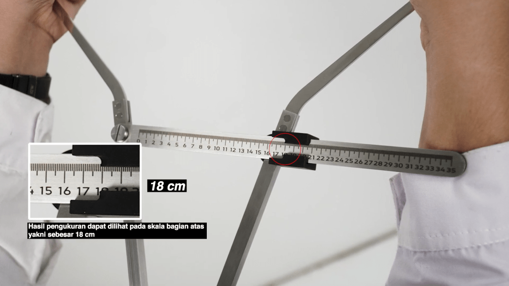 Gambar ini memiliki atribut alt yang kosong; nama filenya adalah Hand-Length-Left-Small-Caliper-2-1024x576.png